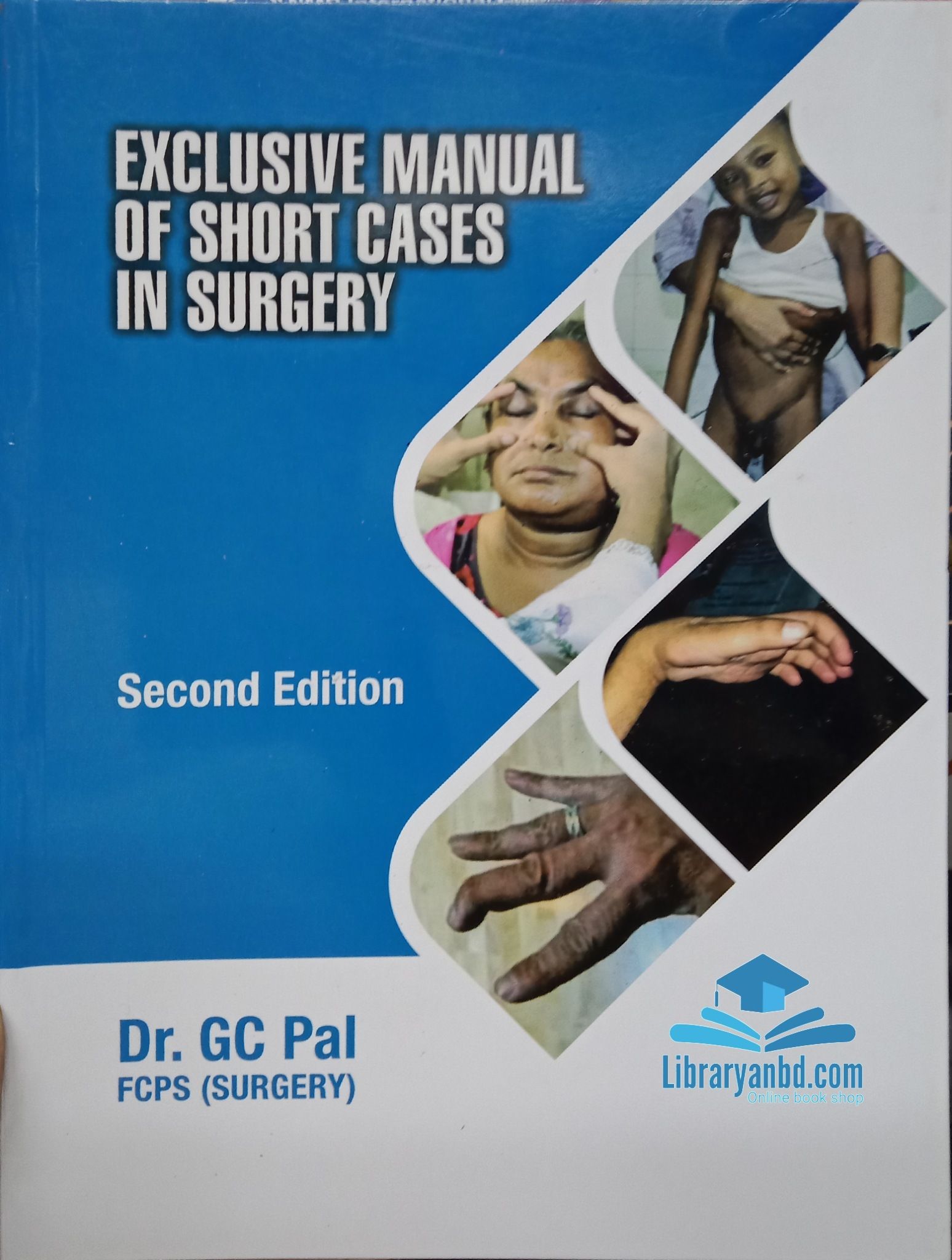 EXCLUSIVE MANUAL OF SHORT CASES IN SURGERY  2nd/E  Dr. GC Pal