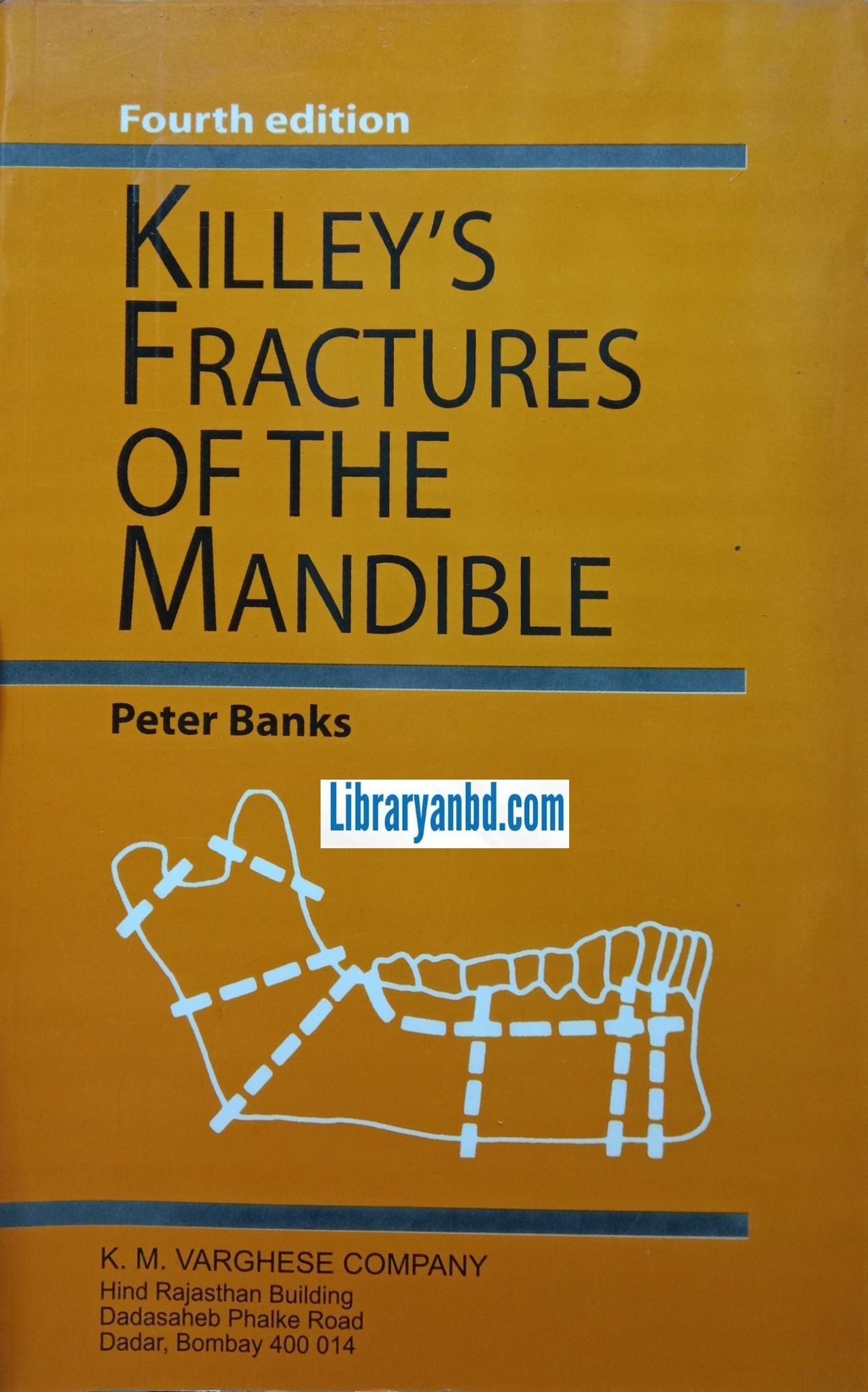 4th/E  KILLEY'S FRACTURES OF THE MANDIBLE