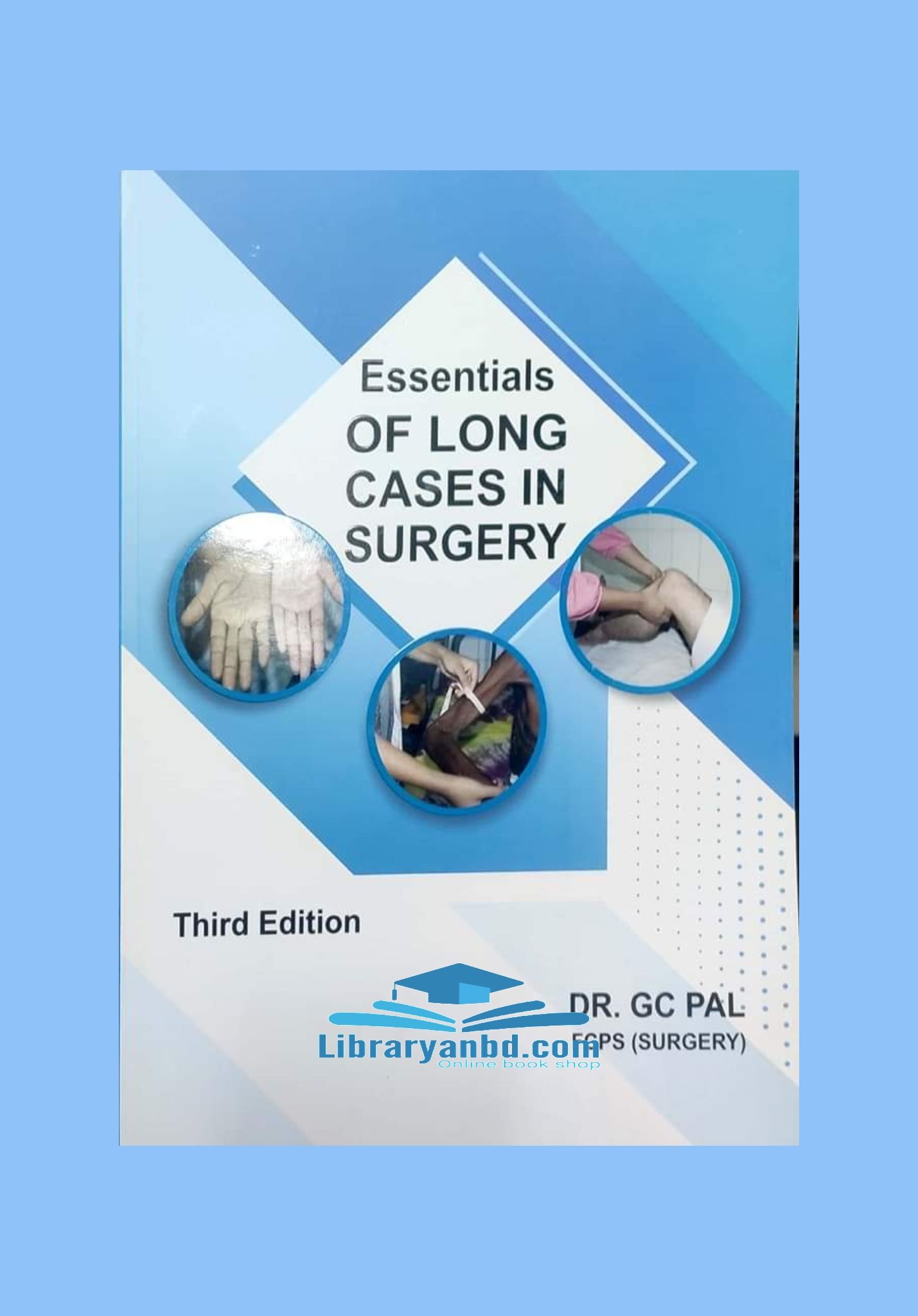 Essentials OF LONG CASES IN SURGERY