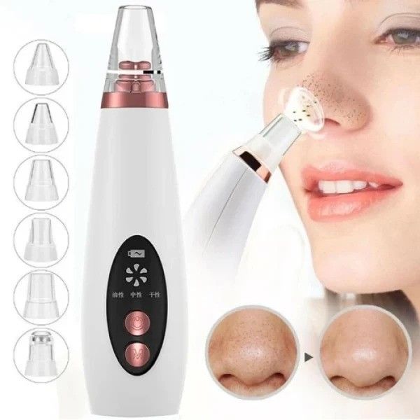 USB Rechargeable Blackhead Remover – ব্ল্যাকহেডস ও হোয়াইটহেডস দূর করার আধুনিক সমাধান