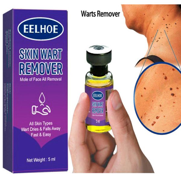 Achill Remover – সহজে পা ও গোড়ালির মৃত চামড়া পরিষ্কার করুন